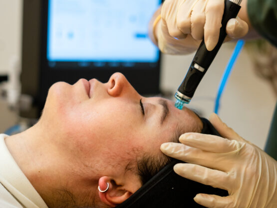 HydraFacial