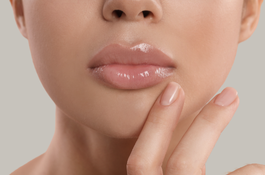 Dermal Fillers