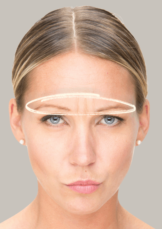 Between Eyebrows