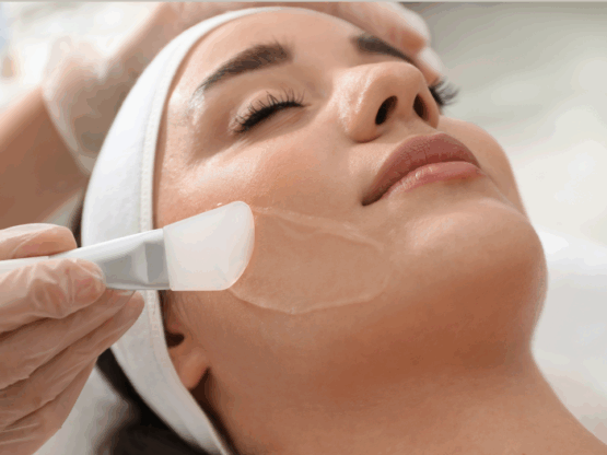 Medical Grade Peels