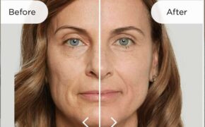 Aesthetic Treatments for Women Over 40: Why More Women Are Choosing MyAesthetics